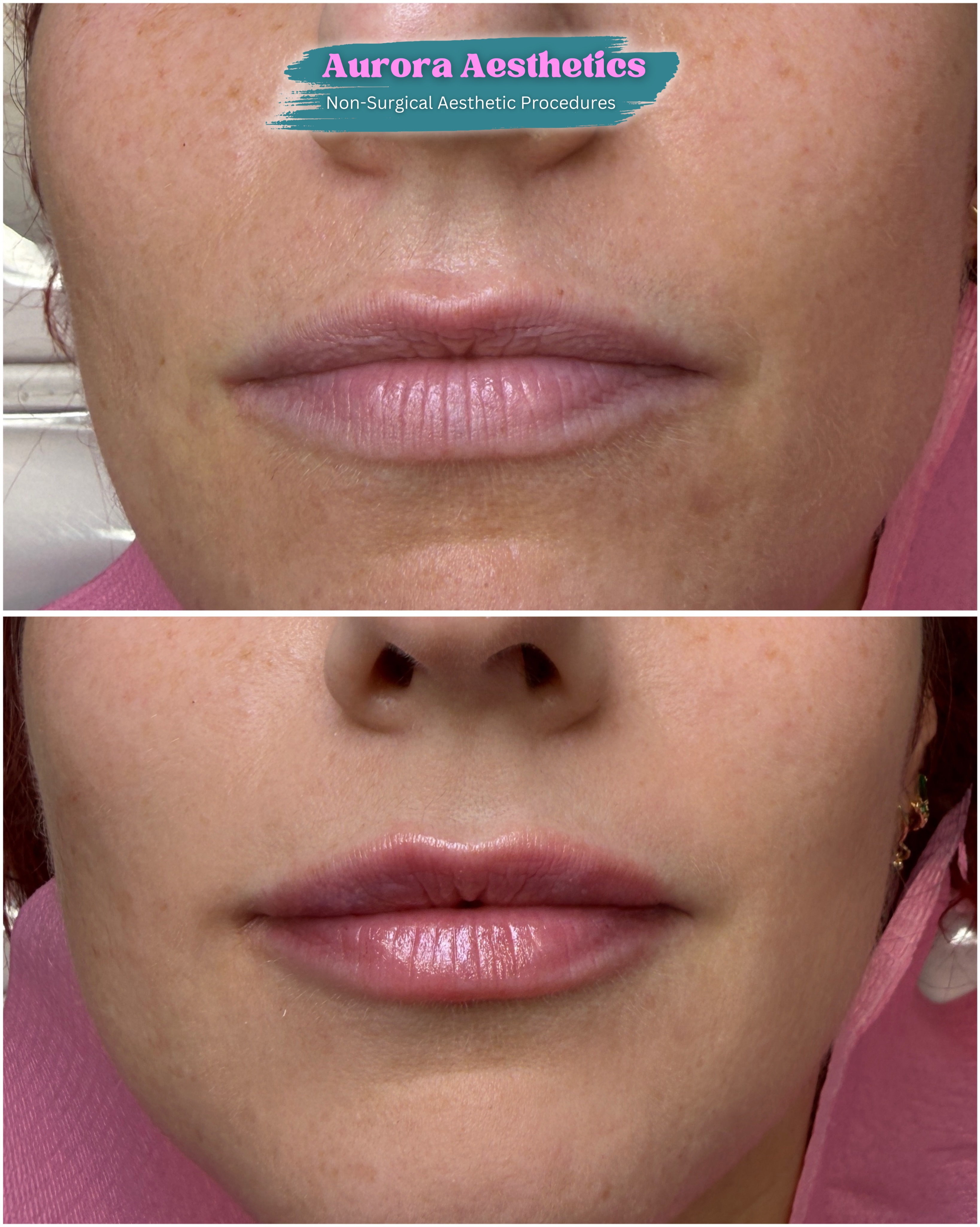 Lips before and after, natural finish