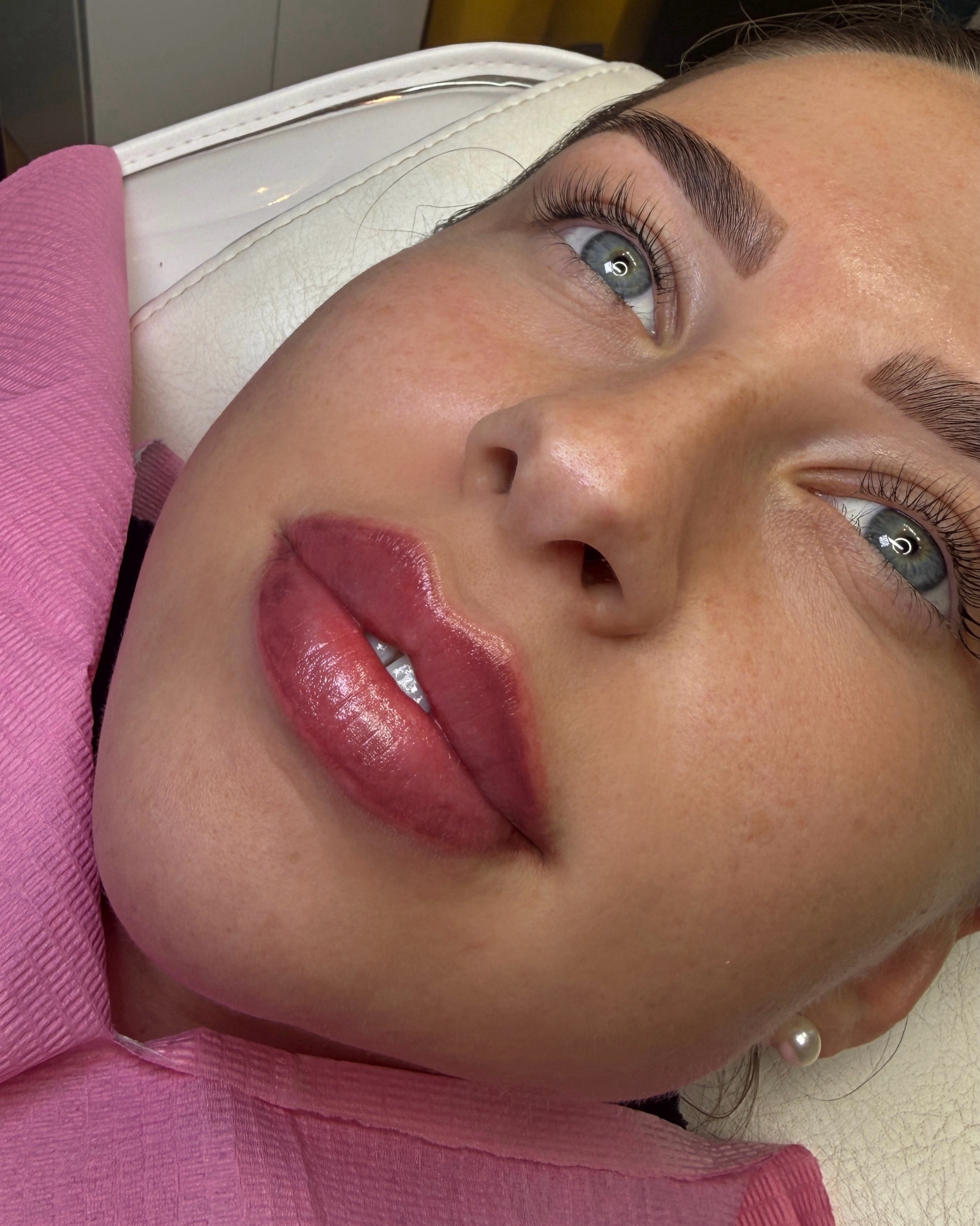 Client relaxing after lip filler at Aurora Aesthetics